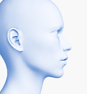 Facial contour after customized facial implant