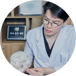 Facial mold creation for customized facial implant