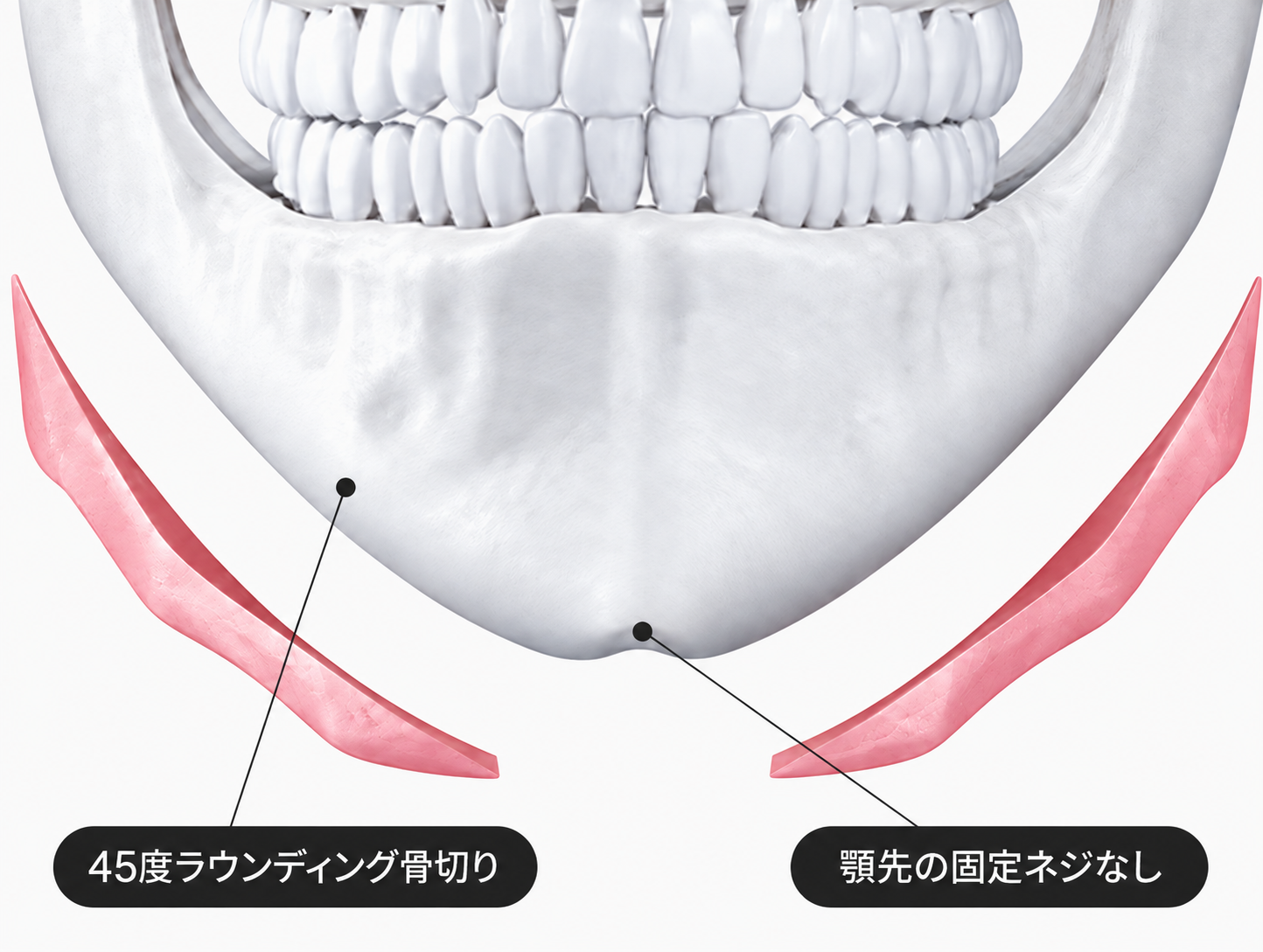 輪郭3点 POINT 02