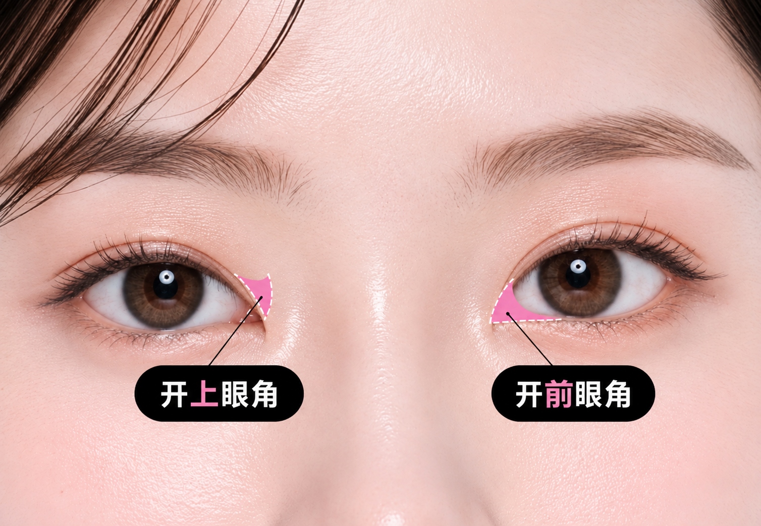 绮林开前·上眼角示意