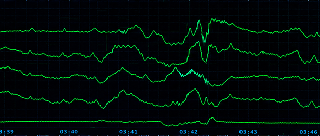 Central monitoring system