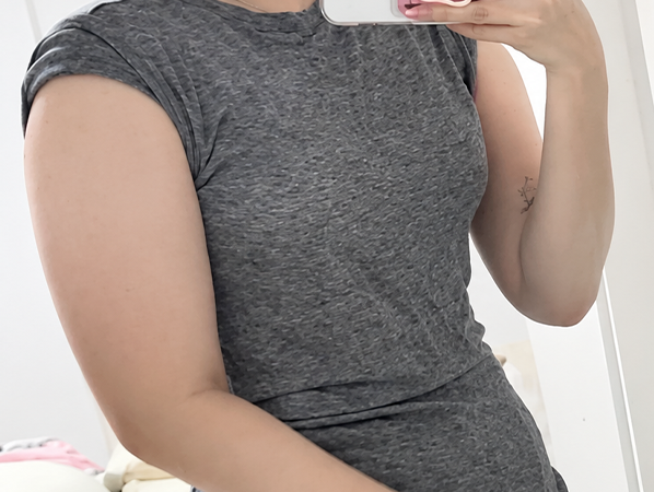 Arm liposuction before