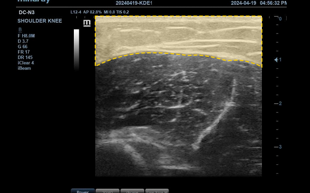 Ultrasound image