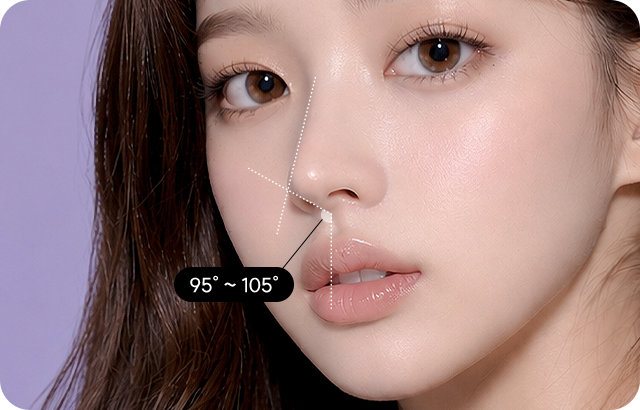 Rhinoplasty facial angle design