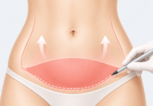 Removal of unnecessary abdominal fat and tissue