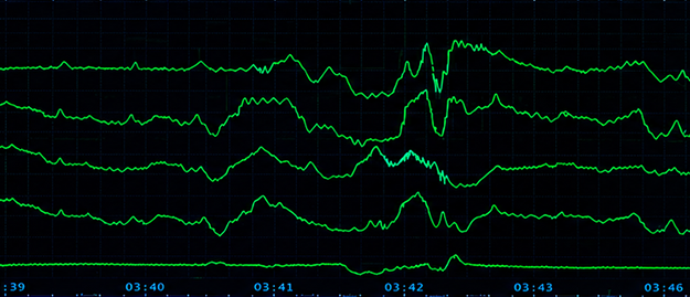 Central monitoring system