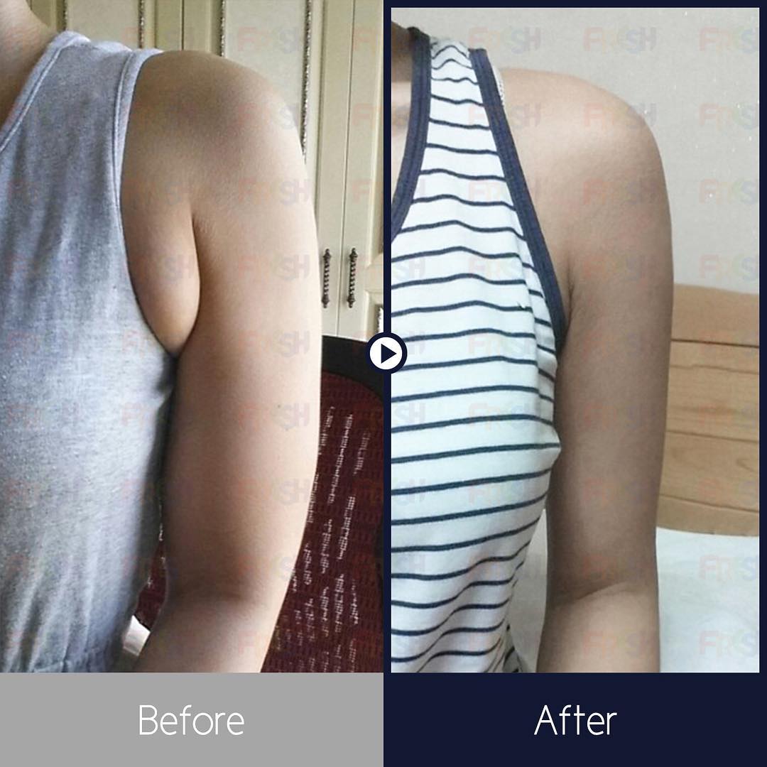 Slim and smooth arms before the Summer : Reviews with photos