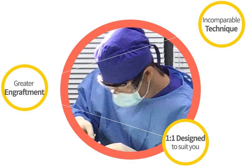 facial liposuction