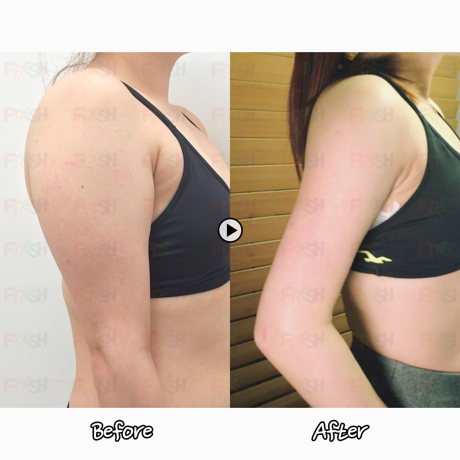 Slimmer arms! : Reviews with photos