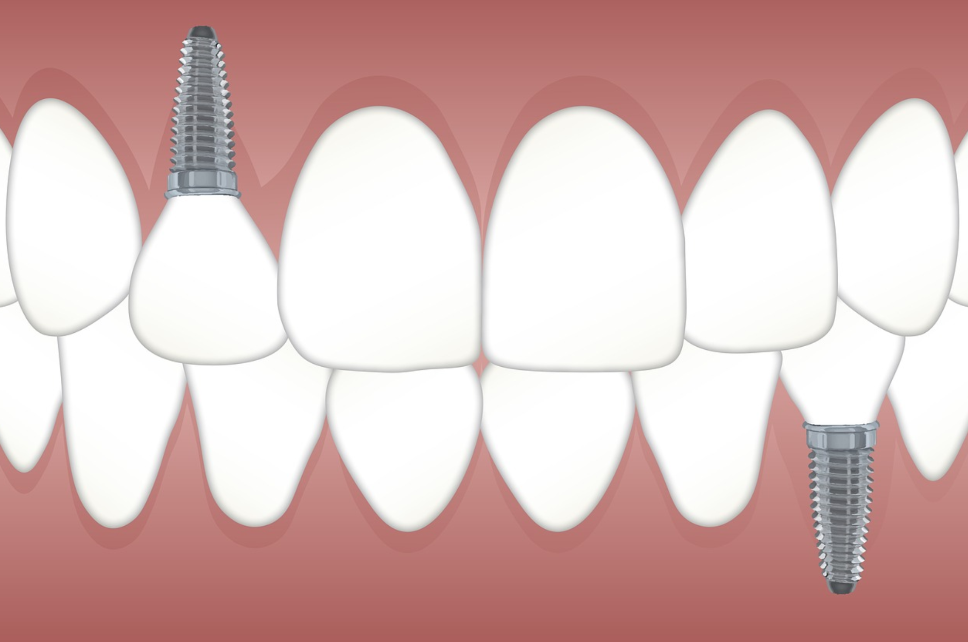 42b832e882028.png