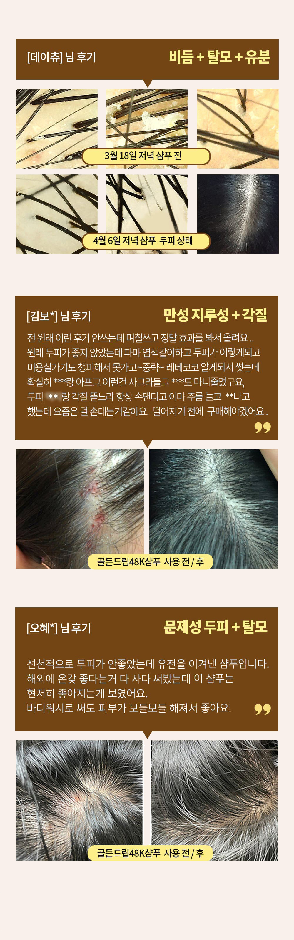 레베코코 골든드립 48K샴푸 400ml [무료배송]