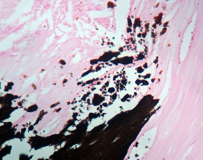 5ce253dd33b97.jpg