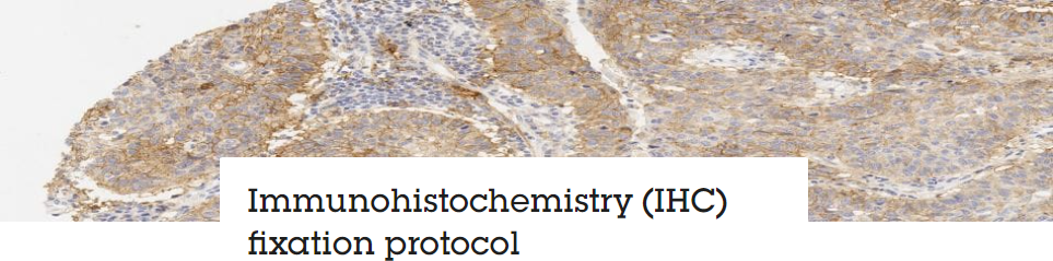 Immunohistochemistry (IHC) Fixation Protocol : Abcam Protocols