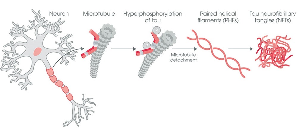 Alzheimer’s Disease (AD) 연구 Tool : Abcam 제품 소개