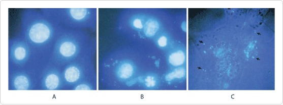 cell-culture-contamination-fig3