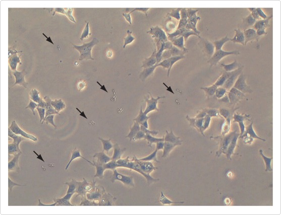 cell-culture-contamination-fig2
