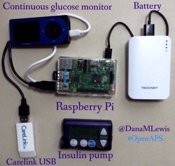 다나 루이스의 'Open Artificial Pancreas System' 관련 Youtube 강연 캡쳐.
