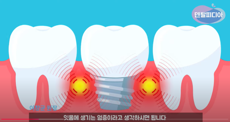 58c88f686bde8.png