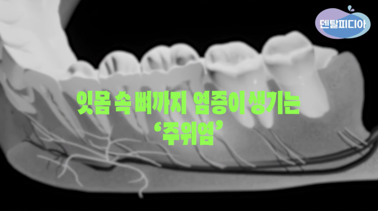 5fb28a0404881.png