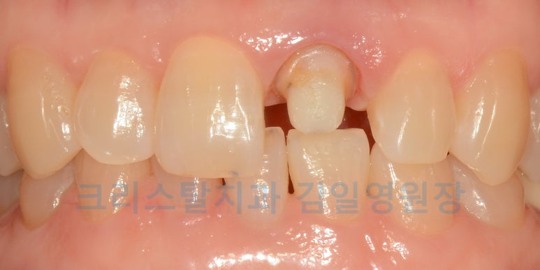 d78610042d711.png