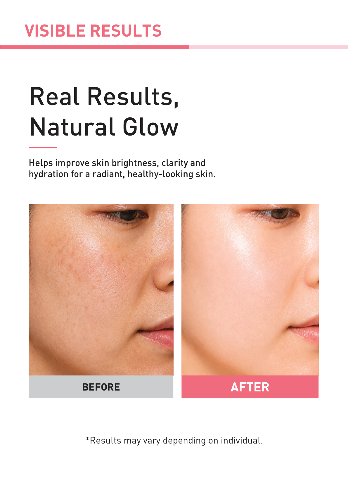 BeadsMax Whitening Skinbooster