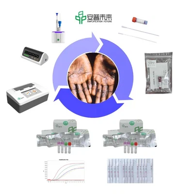 MIRA Monkeypox Virus Nucleic Acid Test Strip Detection Kit Research Use Only
