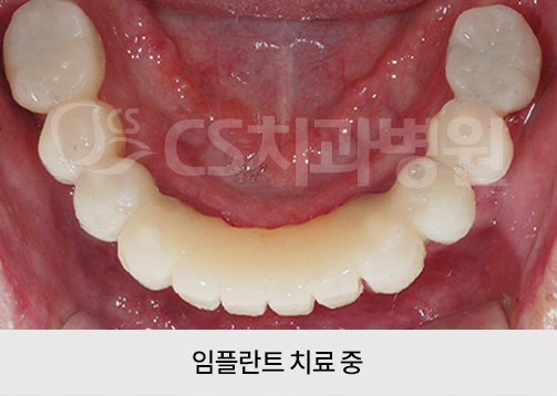 1fe72e54549e2.jpg