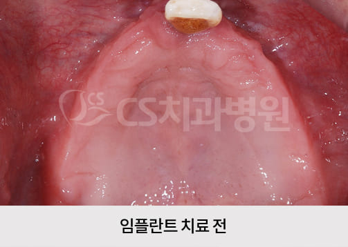 353b142accd21.jpg