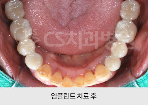 35eae2b3b1006.jpg