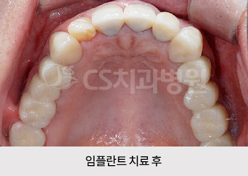 35fb4f13a4811.jpg