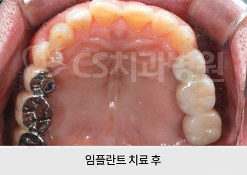 3ce38aa061406.jpg