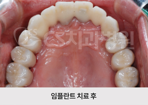 4221d6ae065cd.jpg