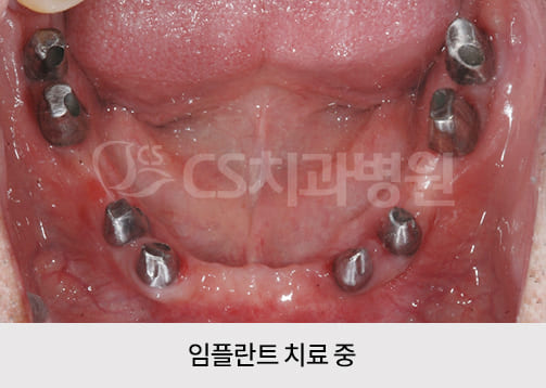 7c92acc0697a0.jpg