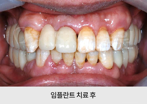 836cd1d5ce539.jpg