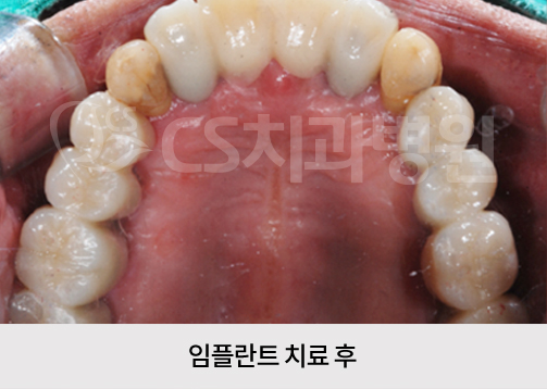 8982b5fa6418f.jpg