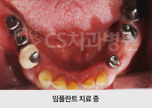 8db215a219381.jpg