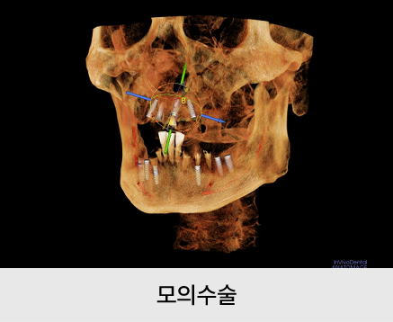 a139889e039a5.png