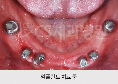 a6fe4643fbf4b.jpg