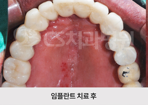 b650265b4726f.jpg