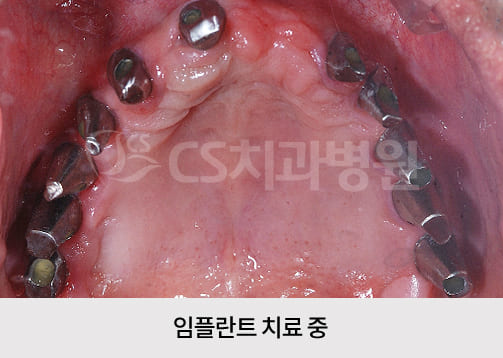bd9e54818c86a.jpg