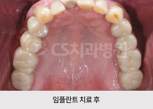 cea44109fe9e4.jpg
