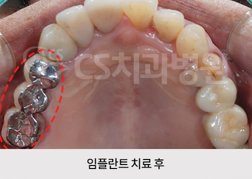 d7cb4e9b337f4.jpg