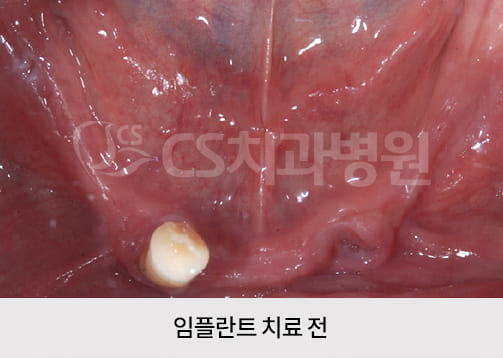 d9573d51bced8.jpg