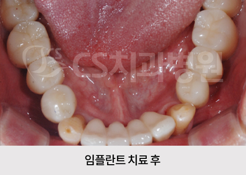 e560b3382b5c7.jpg