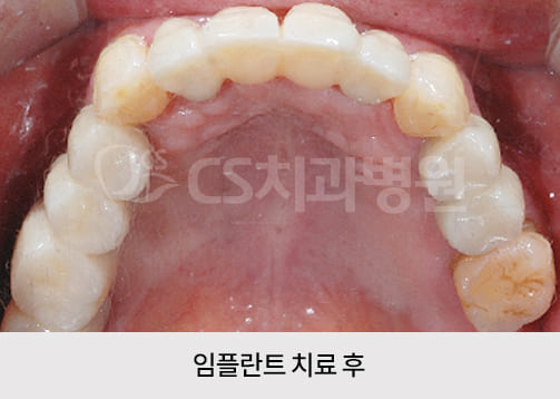 e78d36903dadf.jpg