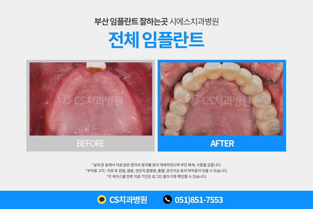 e93503d4ac6d4.jpg