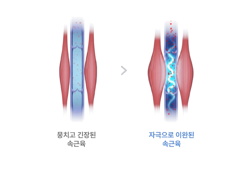 약손드림 허리 EMS 저주파 마사지기 복부 안마기 옆구리 뱃살 제거 보호대 복대 밴드