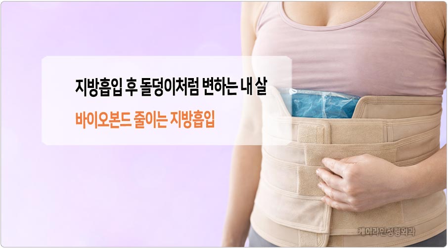 지방흡입후 돌덩이 같은 살 원인