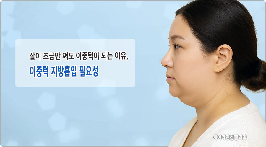 이중턱이 되는 원인