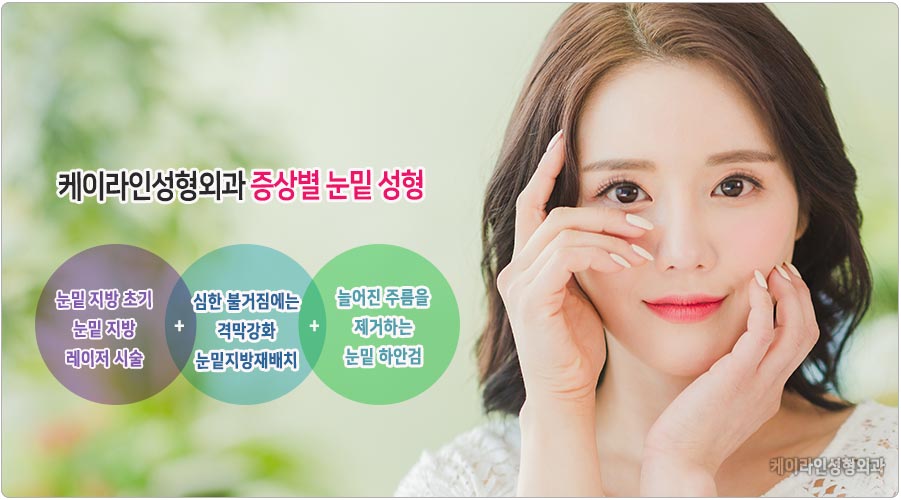 다크서클 치료